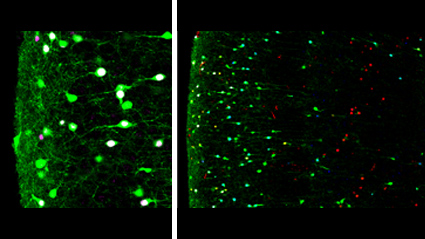 Deciphering the emergence of neuronal diversity