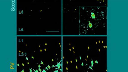 Regulating the brain’s redox state to prevent schizophrenia