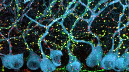 Disorder of neuronal circuits in autism is reversible
