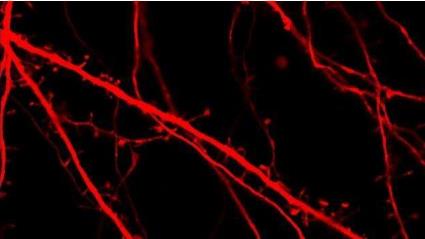 Fluorescent neurons