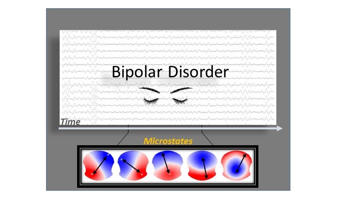 New EEG Study on Euthymic Bipolar Disorder Patients